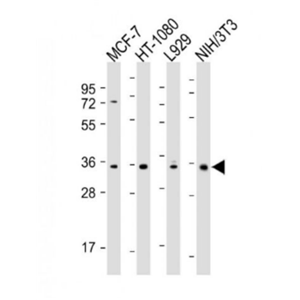Anti-CCND1  antibody-周期素D1单克隆抗体,CCND1