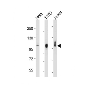 Anti-LAMP2 antibody-溶酶体相关膜蛋白2（CD107B）单克隆抗体