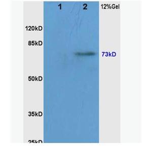 Anti-phospho-RAF1 (Ser338/Tyr340) antibody-磷酸化原癌基因RAF1抗体