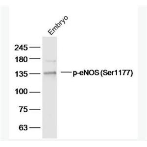 Anti-Phospho-eNOS (Ser1177) antibody-磷酸化一氧化氮合成酶3（内皮型）抗体