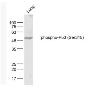Anti-phospho-P53 (Ser315) antibody-磷酸化肿瘤抑制基因P53抗体