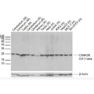 Anti-CSNK2B/CK II betaantibody-丝/苏氨酸蛋白激酶II β重组兔单抗