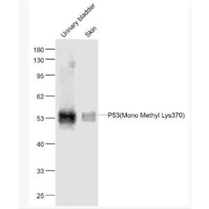 Anti-P53(Mono Methyl Lys370) antibody-甲基化P53(Mono Methyl Lys370)单克隆抗体,P53(Mono Methyl Lys370)
