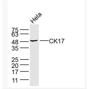 Anti-CK17 antibody-细胞角蛋白17单克隆抗体.