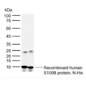 Anti-S100B antibody-人S100B蛋白多克隆抗体,S100B