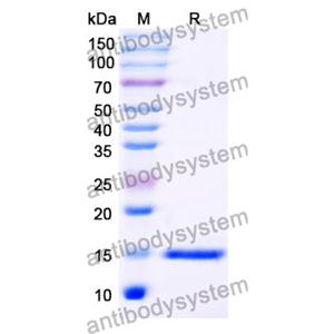 抗 Human MAGEB1 纳米抗体 (SAA0834)(RHE42701),Anti-Human MAGEB1 Nanobody (SAA0834)