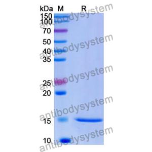 抗 Human MAGEB1 纳米抗体 (SAA1034)(RHE42702),Anti-Human MAGEB1 Nanobody (SAA1034)