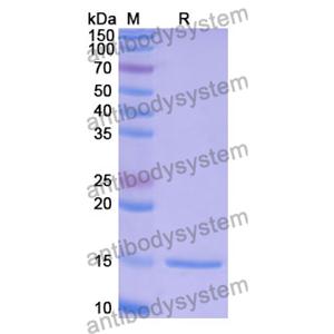 抗 Human MAGEB1 纳米抗体 (SAA1250)(RHE42703),Anti-Human MAGEB1 Nanobody (SAA1250)