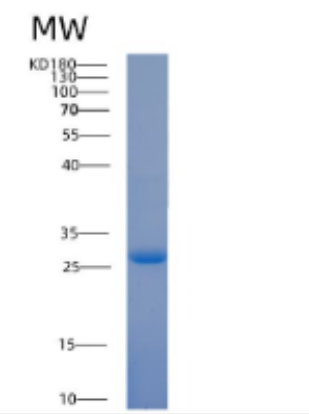 Recombinant Human 14-3-3 τ/ YWHAQ Protein,Recombinant Human 14-3-3 τ/ YWHAQ Protein