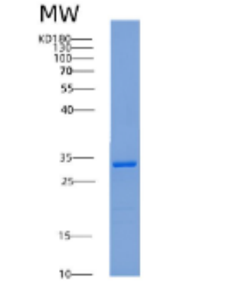 Recombinant Human 14-3-3 ζ/YWHAZ Protein,Recombinant Human 14-3-3 ζ/YWHAZ Protein