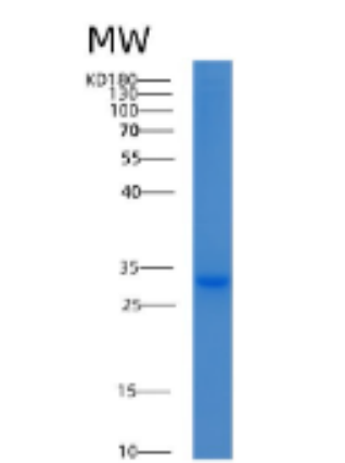 Recombinant Human 14-3-3 eta/YWHAH Protein,Recombinant Human 14-3-3 eta/YWHAH Protein