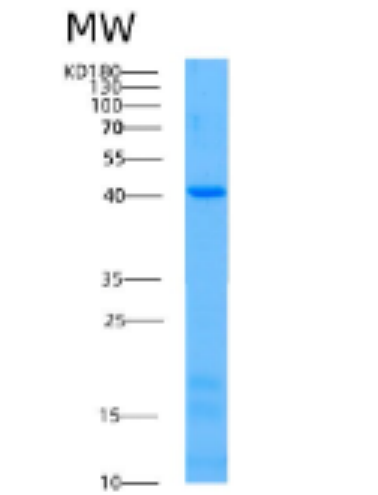 Recombinant Human ACAA2 Protein,Recombinant Human ACAA2 Protein