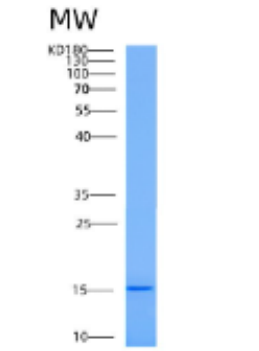 Recombinant AAMDC Protein,Recombinant AAMDC Protein