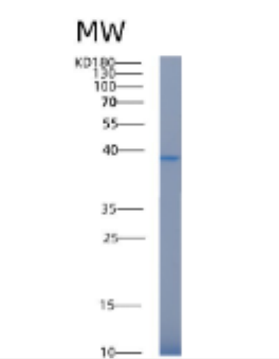 Recombinant Human AKR1C3 Protein,Recombinant Human AKR1C3 Protein