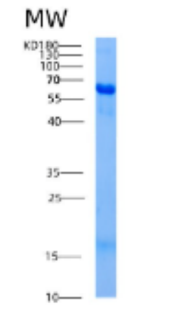 Recombinant Human AK5 Protein,Recombinant Human AK5 Protein