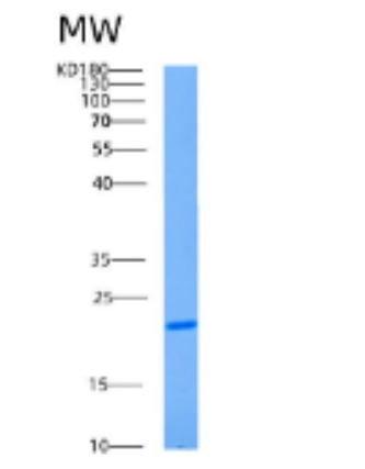 Recombinant Human AK1 Protein,Recombinant Human AK1 Protein