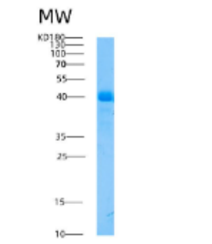 Recombinant Human AHSG Protein,Recombinant Human AHSG Protein