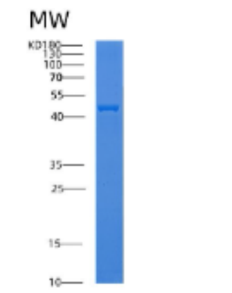 Recombinant Human ADPRH Protein,Recombinant Human ADPRH Protein