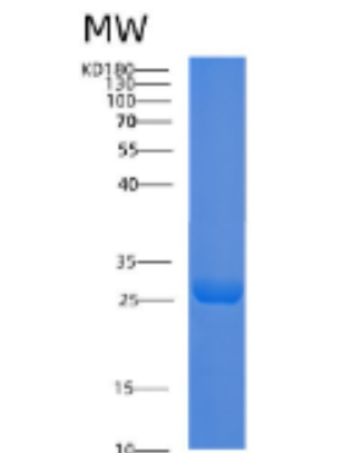 Recombinant Mouse Adiponectin Protein,Recombinant Mouse Adiponectin Protein