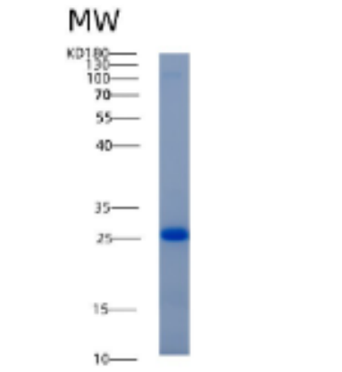 Recombinant Human ADI1 Protein,Recombinant Human ADI1 Protein