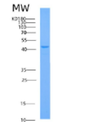 Recombinant Human ADH1C Protein,Recombinant Human ADH1C Protein