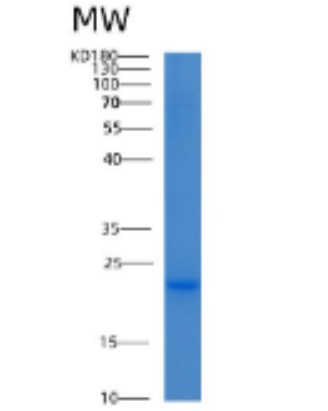 Recombinant Human ADAT2 Protein,Recombinant Human ADAT2 Protein