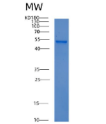 Recombinant Mouse Acy1 Protein,Recombinant Mouse Acy1 Protein