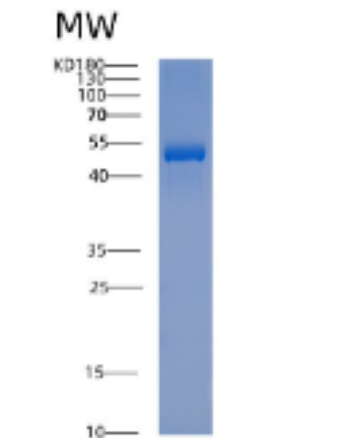 Recombinant Human ACTR3 Protein,Recombinant Human ACTR3 Protein