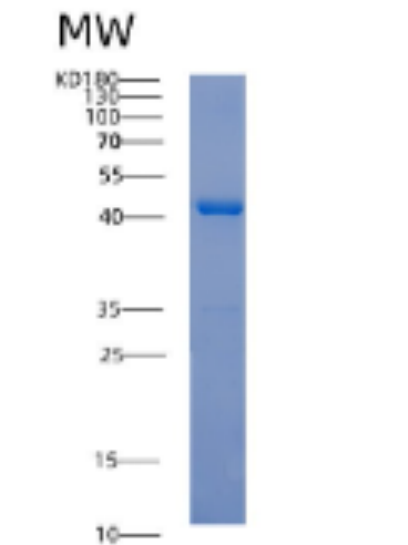 Recombinant Human ACTA2 Protein,Recombinant Human ACTA2 Protein