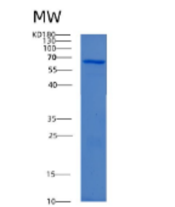 Recombinant Human ACADVL Protein,Recombinant Human ACADVL Protein