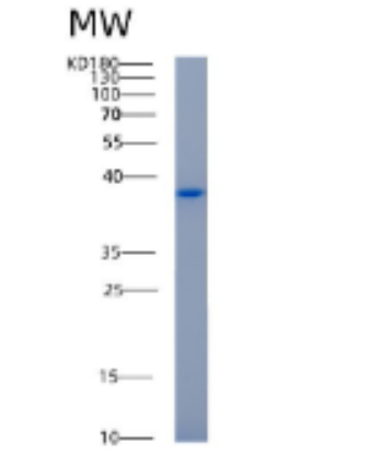 Recombinant Human AKR1C1 Protein,Recombinant Human AKR1C1 Protein