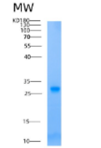 Recombinant Human AK2 Protein,Recombinant Human AK2 Protein