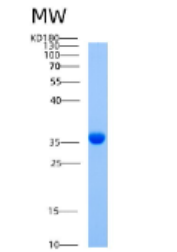 Recombinant Human AIMP1 (Aminoacyl tRNA synthetase complex-interacting multifunctional protein 1) Protein,Recombinant Human AIMP1 (Aminoacyl tRNA synthetase complex-interacting multifunctional protein 1) Protein