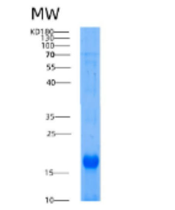 Recombinant Human AIF1 Protein,Recombinant Human AIF1 Protein