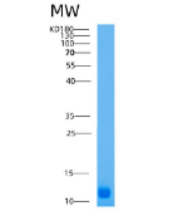 Recombinant Human AHSP Protein,Recombinant Human AHSP Protein