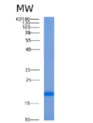 Recombinant Human AGR3 Protein,Recombinant Human AGR3 Protein