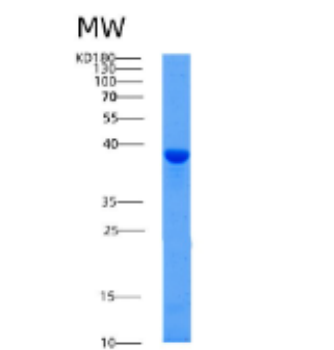 Recombinant Human AFAP1 Protein,Recombinant Human AFAP1 Protein