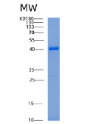 Recombinant Human ADPRHL2 Protein,Recombinant Human ADPRHL2 Protein