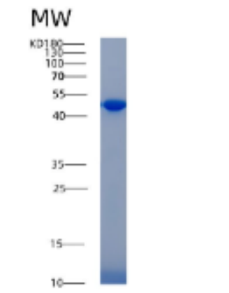 Recombinant Human ACPP Protein,Recombinant Human ACPP Protein