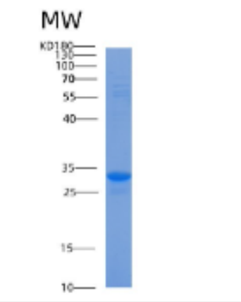 Recombinant Human ACBD6 Protein,Recombinant Human ACBD6 Protein