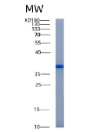 Recombinant Human AKR1B10 Protein,Recombinant Human AKR1B10 Protein