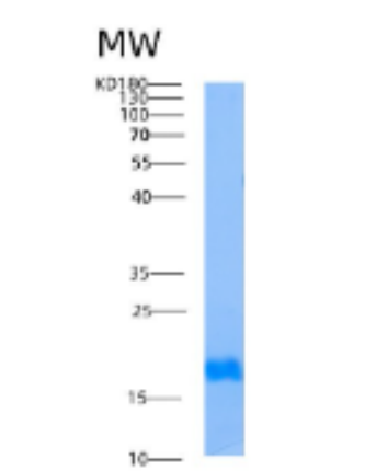 Recombinant Human AIMP3 (Aminoacyl tRNA synthetase complex-interacting multifunctional protein 3) Protein,Recombinant Human AIMP3 (Aminoacyl tRNA synthetase complex-interacting multifunctional protein 3) Protein