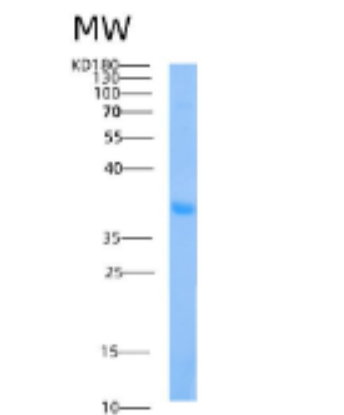 Recombinant Human AIDA Protein,Recombinant Human AIDA Protein