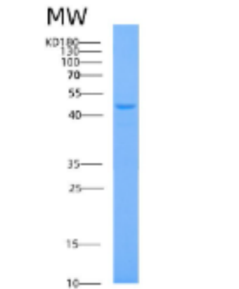 Recombinant Human AHCY Protein,Recombinant Human AHCY Protein