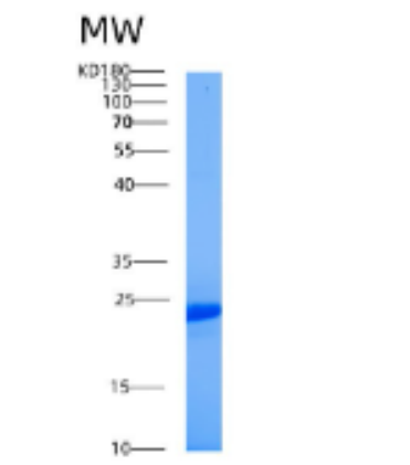 Recombinant Human AES Protein,Recombinant Human AES Protein