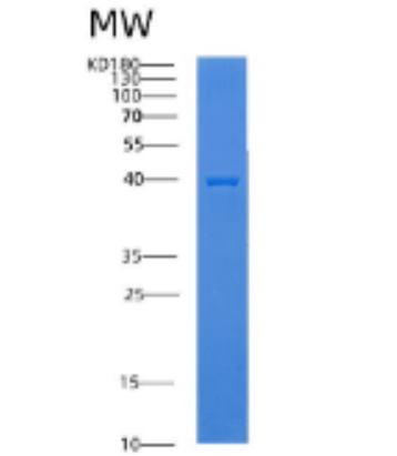 Recombinant Human ADK Protein,Recombinant Human ADK Protein