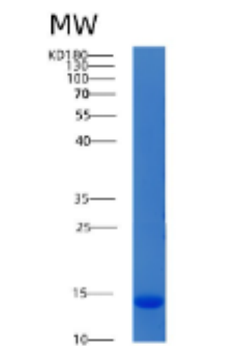 Recombinant Human ACYP1 Protein,Recombinant Human ACYP1 Protein