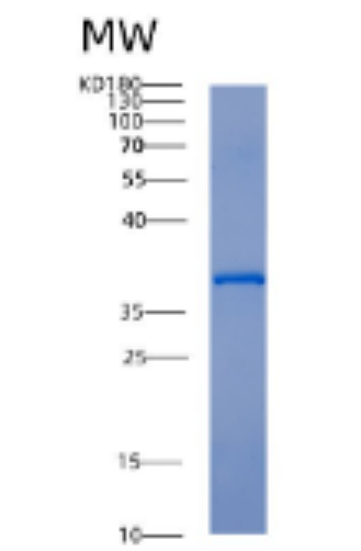 Recombinant Human Activator of Hsp90 ATPase-1 /AHA1 Protein,Recombinant Human Activator of Hsp90 ATPase-1 /AHA1 Protein