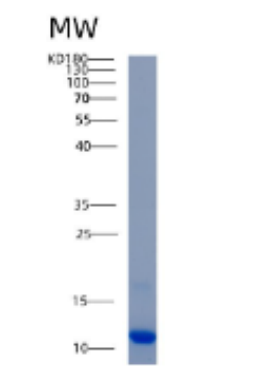 Recombinant Human AKAP7 Protein,Recombinant Human AKAP7 Protein