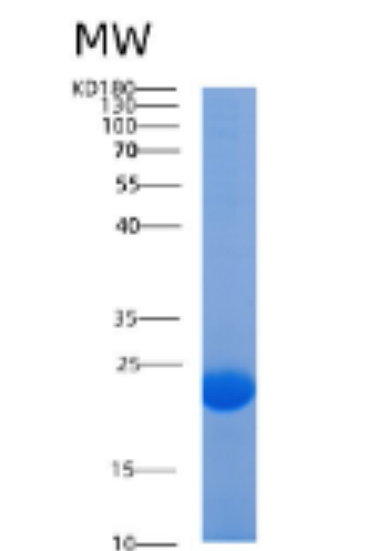 Recombinant Human AGR 2 Protein,Recombinant Human AGR 2 Protein